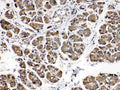 Anti-Amylase/AMY1A/AMY1B/AMY1C Antibody Picoband®