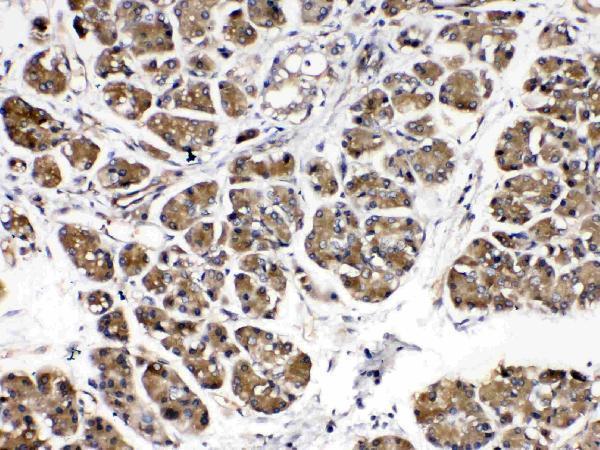 Anti-Amylase/AMY1A/AMY1B/AMY1C Antibody Picoband®