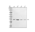 Anti-NAT6/FUS2/NAA80 Antibody Picoband®
