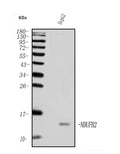 Anti-NDUFB2 Antibody Picoband®