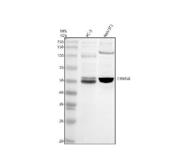 Anti-TRIM58 Antibody Picoband®