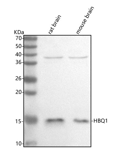 Anti-HBQ1 Antibody Picoband®