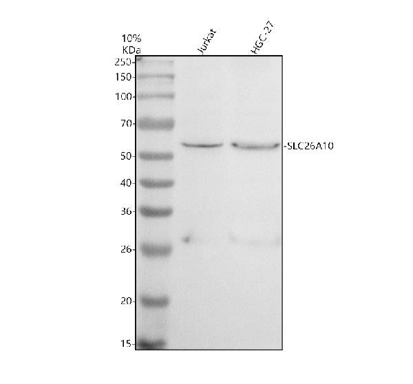 Anti-SLC26A10P Antibody Picoband®