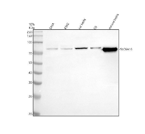 Anti-SLC6A16 Antibody Picoband®