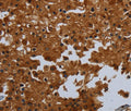 ENTPD7 Polyclonal Antibody – Figure 1 of 3