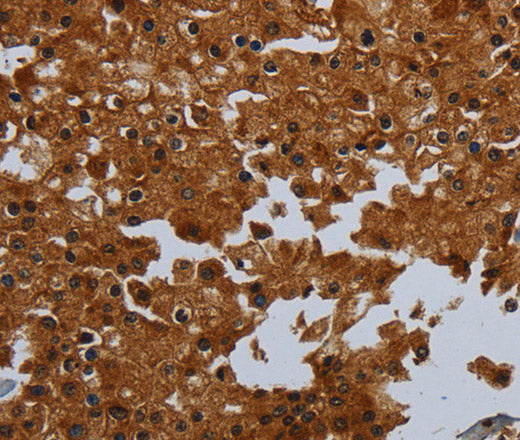 ENTPD7 Polyclonal Antibody – Figure 1 of 3