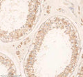 Anti-SLC22A14 Antibody