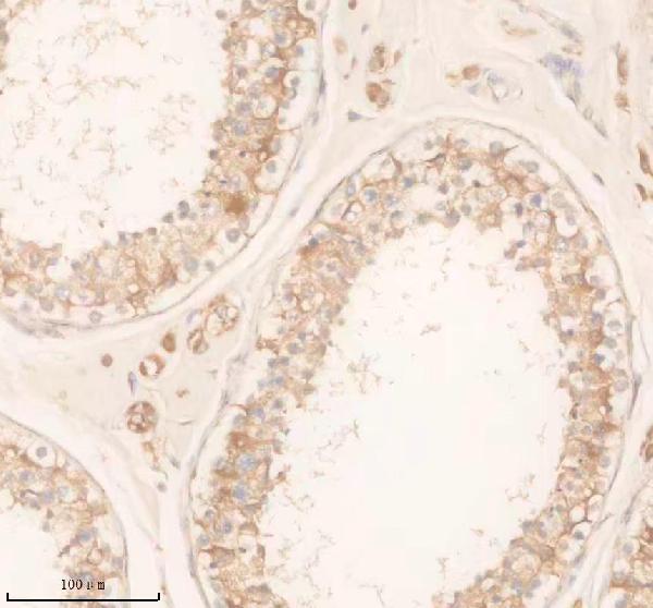 Anti-SLC22A14 Antibody