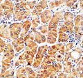 Anti-SLC46A3 Antibody