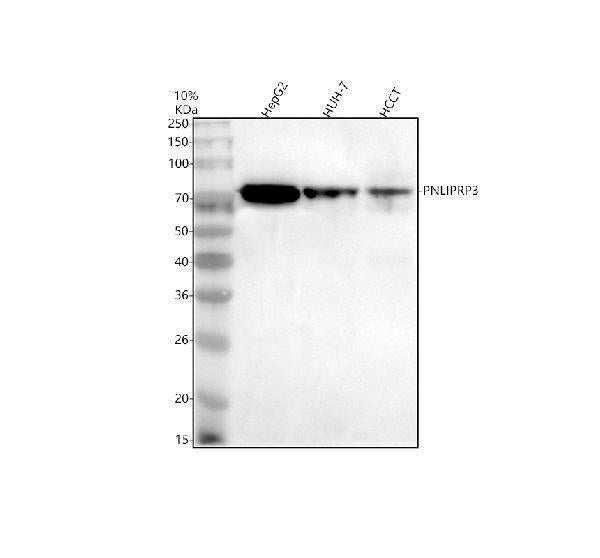 Anti-PNLIPRP3 Antibody Picoband®
