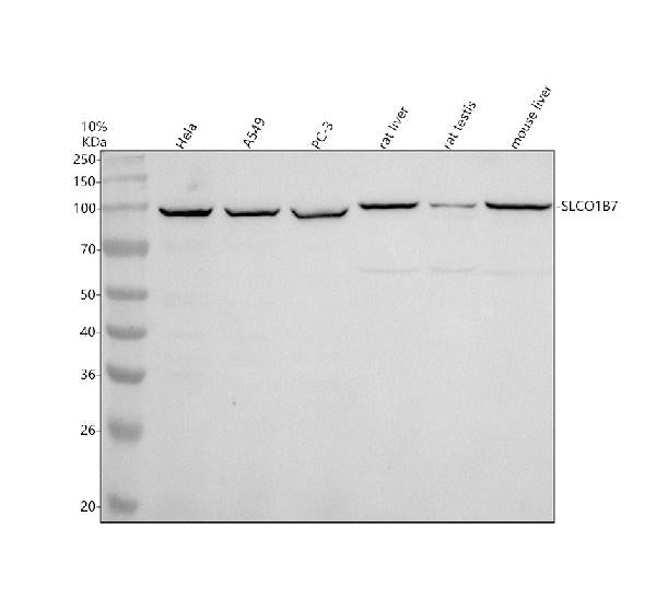 Anti-SLCO1B7 Antibody Picoband®