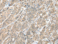 HIF1A Polyclonal Antibody – Figure 1 of 3