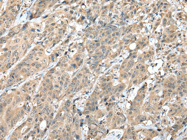 HIF1A Polyclonal Antibody – Figure 1 of 3