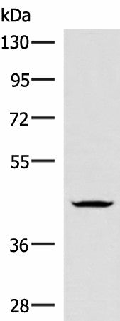 HMBOX1 Polyclonal Antibody – Figure 1 of 4