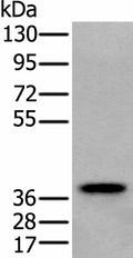 ZPBP Polyclonal Antibody – Figure 1 of 4