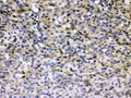 Anti-Hepatitis B Virus Antibody Picoband®