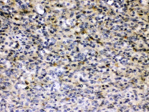 Anti-Hepatitis B Virus Antibody Picoband®