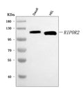 Anti-FAM65B/RIPOR2 Antibody Picoband®