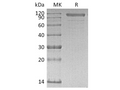 Recombinant Human Cadherin-6/CDH6 Protein (His Tag) - Figure 1 of 2