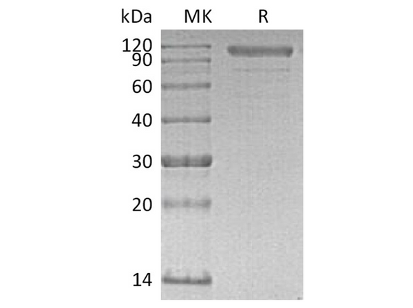 Recombinant Human Cadherin-6/CDH6 Protein (His Tag) - Figure 1 of 2