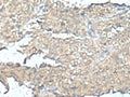 MEF2D Polyclonal Antibody – Figure 1 of 3