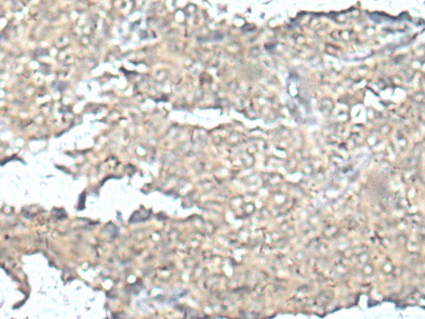 MEF2D Polyclonal Antibody – Figure 1 of 3