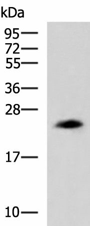 CLTB Polyclonal Antibody – Figure 1 of 4