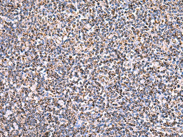 HSF2BP Polyclonal Antibody – Figure 1 of 3