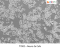 Neuro-2a Cells | Applied Biological Materials (abm)