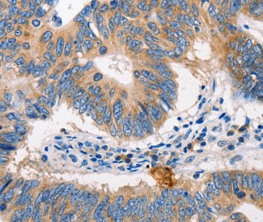 MTOR Polyclonal Antibody – Figure 1 of 3
