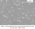 Immortalized Oral Cancer Associated Fibroblast Cells (UM-SCC-122-CAF) - SV40T + SV40 | Applied Biological Materials (abm)