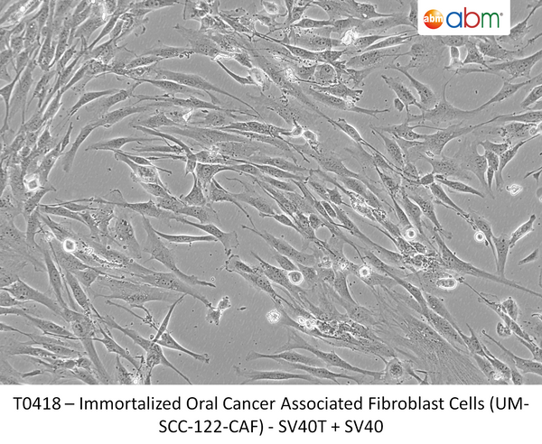 Immortalized Oral Cancer Associated Fibroblast Cells (UM-SCC-122-CAF) - SV40T + SV40 | Applied Biological Materials (abm)