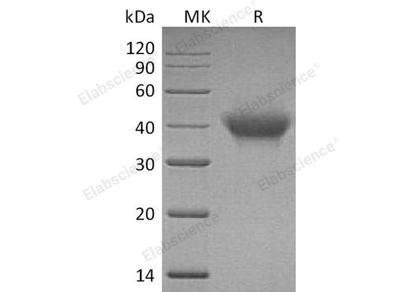 Recombinant Human IL5RA/IL-5 Rα Protein (His Tag) – Figure 1 of 2