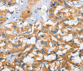 CXCL14 Polyclonal Antibody – Figure 1 of 2