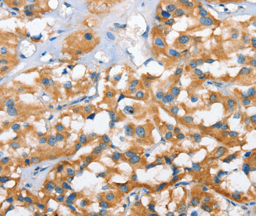 CXCL14 Polyclonal Antibody – Figure 1 of 2