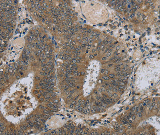 HSD3B1 Polyclonal Antibody – Figure 1 of 2