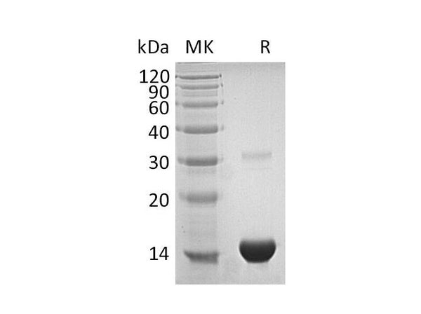 Recombinant Human Thioredoxin/TXN Protein (His Tag) – Figure 1 of 2
