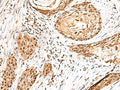 ELF3 Polyclonal Antibody – Figure 1 of 2