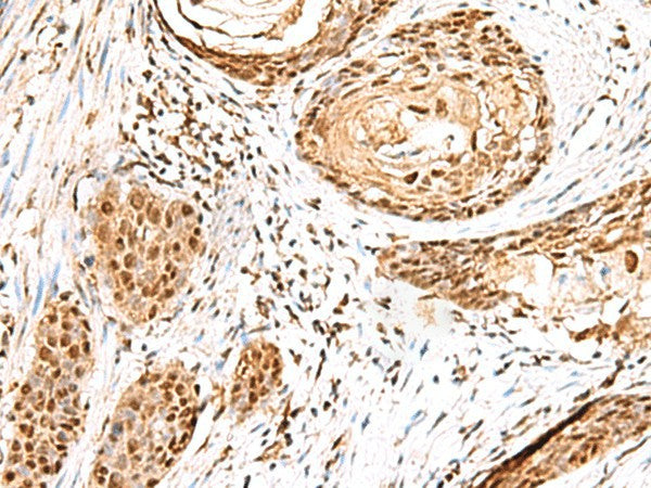 ELF3 Polyclonal Antibody – Figure 1 of 2