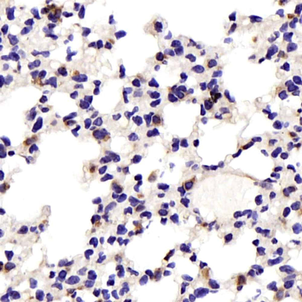 JNK1/2/3 Polyclonal Antibody – Figure 1 of 4