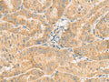 NCOA4 Polyclonal Antibody – Figure 1 of 3