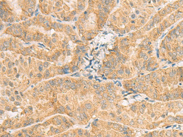 NCOA4 Polyclonal Antibody – Figure 1 of 3