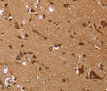 EDN3 Polyclonal Antibody – Figure 1 of 3