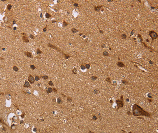 EDN3 Polyclonal Antibody – Figure 1 of 3