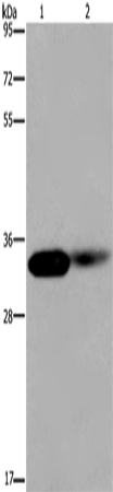 LIMS1 Polyclonal Antibody – Figure 1 of 4