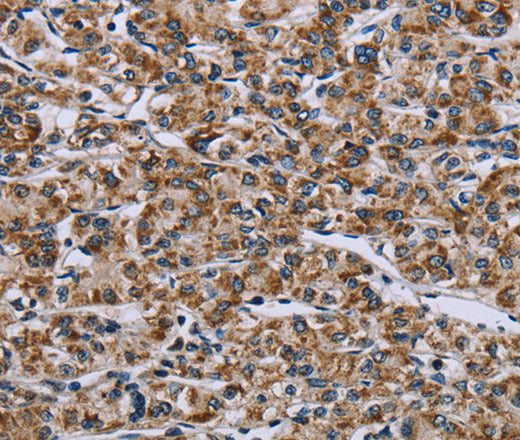 GTPBP10 Polyclonal Antibody – Figure 1 of 2