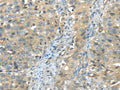 ISM2 Polyclonal Antibody – Figure 1 of 3