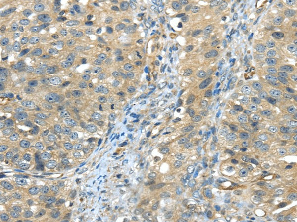 ISM2 Polyclonal Antibody – Figure 1 of 3