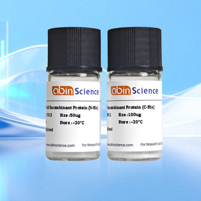 Recombinant Human FBXO32 Protein, N-His