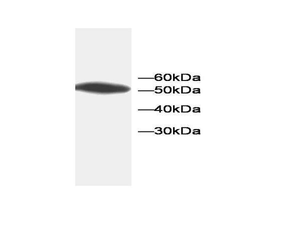 Anti-ANX5 Antibody – Figure 1 of 1